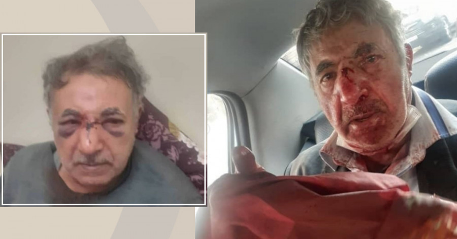 ضرب و شتم و جرح یک مرد میانسال توسط عوامل شهرداری در تبریز