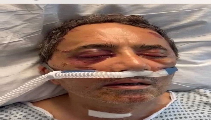 فوری: احمد اوبالی مورد سوء قصد قرار گرفت