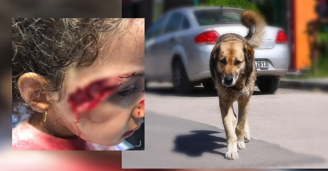 حمله سگ‌های ولگرد به دختربچه ۵ ساله در تبریز