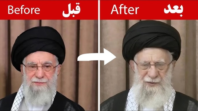 گزارش اندیشکده آلمانی درباره وخامت سلامت خامنه‌ای