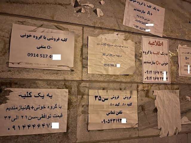 افزایش فروش اعضای بدن در ایران به دلیل فقر